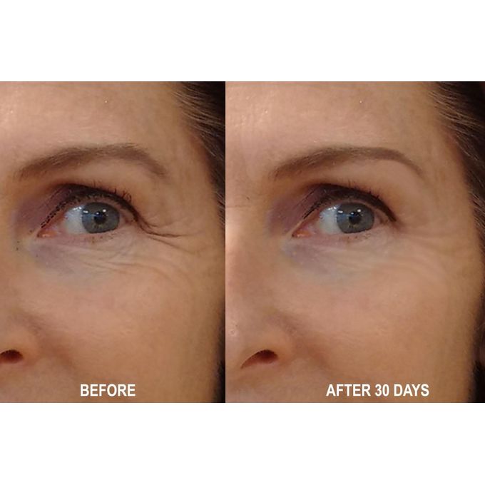 The Ordinary Rétinol 1% dans du Squalane - Sérum Anti-age